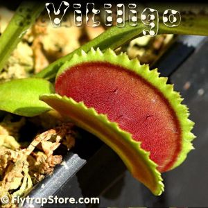 Vitiligo Venus fly trap